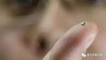 您对未来数字助听器有哪些期待