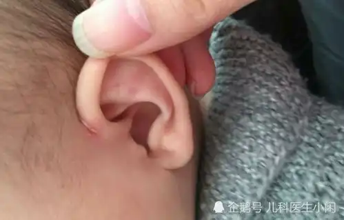 宝宝抓耳朵拍脑袋,父母千万不能大意